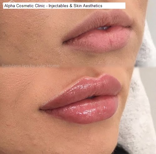 Mondays 3 Beauty Salon Open in Carss Park, NSW: Alpha Cosmetic Clinic - Injectables & Skin Aesthetics,The Chemist Shop,Carss Park Flats Parking,