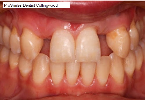 Saturday 4 Dentist Open in Collingwood, VIC: ProSmiles Dentist Collingwood,Collingwood Dental Practice,Stanley Street Dental,SMILEE Dental,